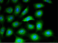 (ibidi) μ-Dish 35 mm培養皿-81156 81151 80136 80131 81158